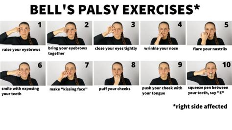 bell palsy exercises